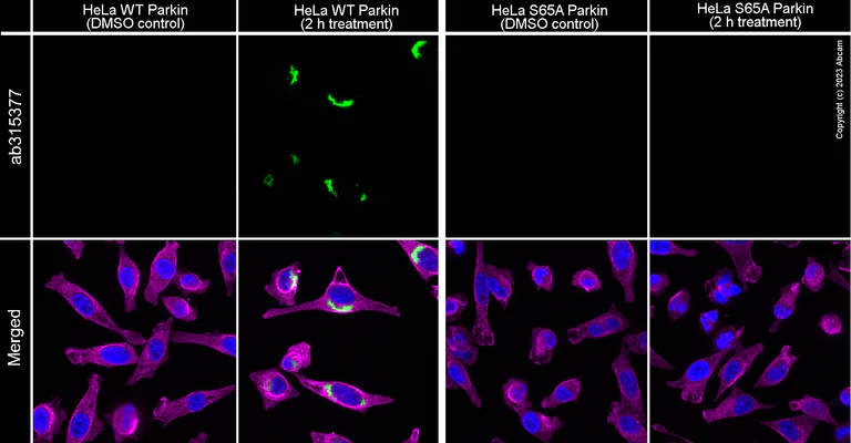 Immunocytochemistry/ Immunofluorescence - Anti-Parkin (phospho S65) antibody [MJF-R17-42-4] - BSA and Azide free (AB315377)