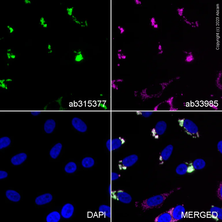 Immunocytochemistry/ Immunofluorescence - Anti-Parkin (phospho S65) antibody [MJF-R17-42-4] - BSA and Azide free (AB315377)