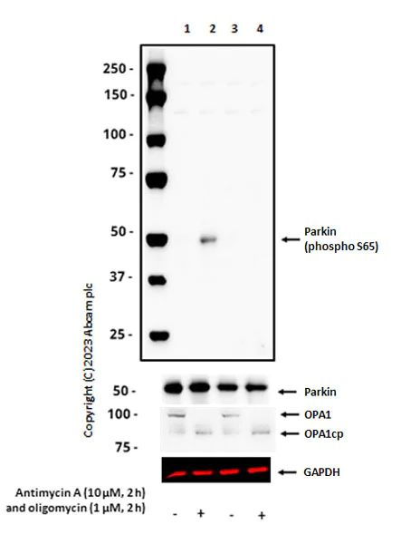 Western blot - Anti-Parkin (phospho S65) antibody [MJF-R17-42-4] - BSA and Azide free (AB315377)