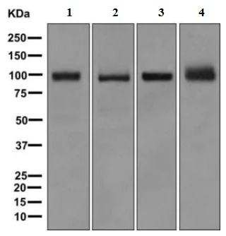 Western blot - Anti-PARM-1 antibody [EPR10009] (AB168369)