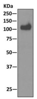 Immunoprecipitation - Anti-PARM-1 antibody [EPR10009] - BSA and Azide free (AB249463), expandable thumbnail