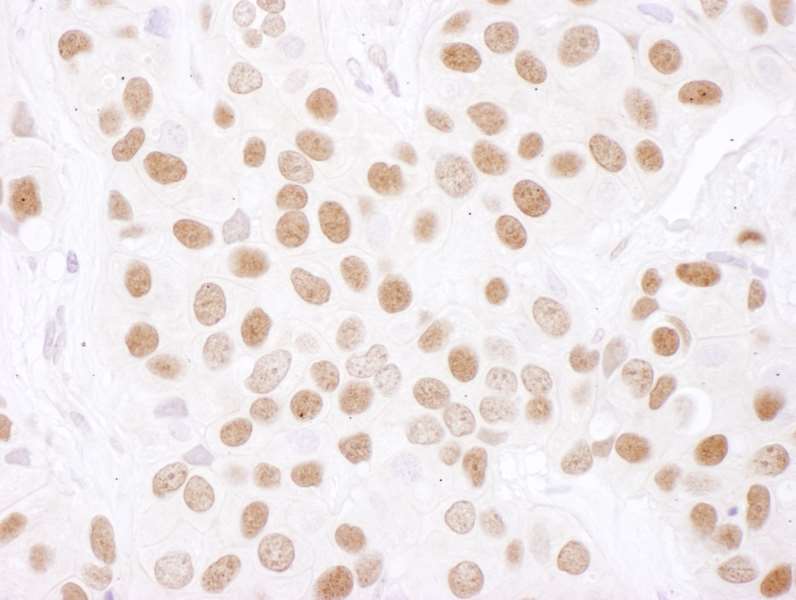 Immunohistochemistry (Formalin/PFA-fixed paraffin-embedded sections) - Anti-PARN antibody (AB125185)
