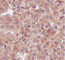Immunohistochemistry (Formalin/PFA-fixed paraffin-embedded sections) - Anti-PARN antibody [EPR11670(2)] (AB188333)