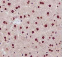 Immunohistochemistry (Formalin/PFA-fixed paraffin-embedded sections) - Anti-PARN antibody [EPR11670(2)] (AB188333)