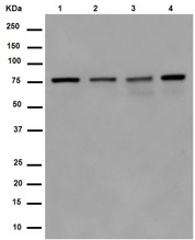 Western blot - Anti-PARN antibody [EPR11670(2)] (AB188333)