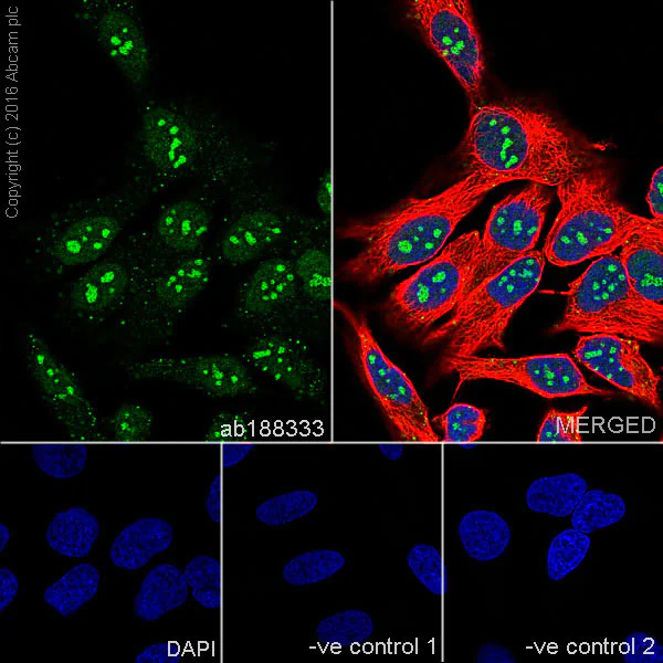 Immunocytochemistry/ Immunofluorescence - Anti-PARN antibody [EPR11670(2)] - BSA and Azide free (AB250959)