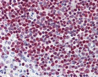 Immunohistochemistry (Formalin/PFA-fixed paraffin-embedded sections) - Anti-PARP1 antibody [A6.4.12] (AB110915), expandable thumbnail