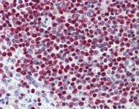 Immunohistochemistry (Formalin/PFA-fixed paraffin-embedded sections) - Anti-PARP1 antibody [A6.4.12] (AB110915)