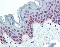 Immunohistochemistry (Formalin/PFA-fixed paraffin-embedded sections) - Anti-PARP1 antibody [A6.4.12] (AB110915), expandable thumbnail
