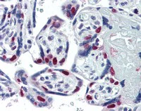 Immunohistochemistry (Formalin/PFA-fixed paraffin-embedded sections) - Anti-PARP1 antibody [A6.4.12] (AB110915)