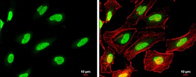 Immunocytochemistry/ Immunofluorescence - Anti-PARP1 antibody (AB137653)