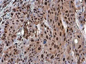 Immunohistochemistry (Formalin/PFA-fixed paraffin-embedded sections) - Anti-PARP1 antibody (AB137653)