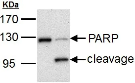 Western blot - Anti-PARP1 antibody (AB137653)