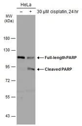 Western blot - Anti-PARP1 antibody (AB137653)