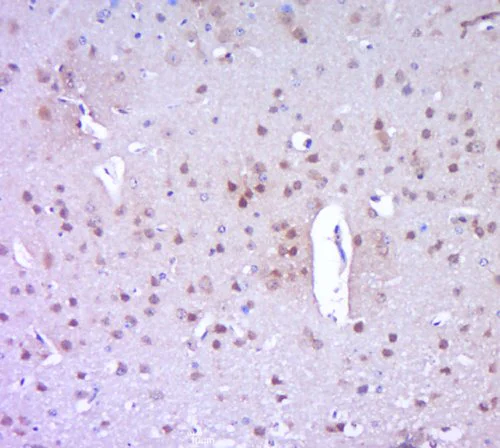 Immunohistochemistry (Formalin/PFA-fixed paraffin-embedded sections) - Anti-PARP1 antibody (AB218132)