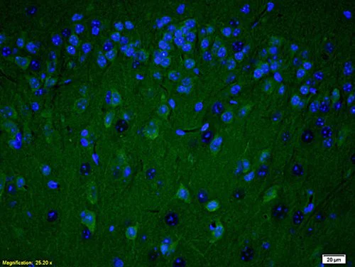Immunohistochemistry (Formalin/PFA-fixed paraffin-embedded sections) - Anti-PARP1 antibody (AB218132)