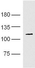 Western blot - Anti-PARP1 antibody (AB218132)