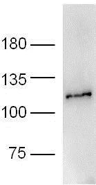 Western blot - Anti-PARP1 antibody (AB218132)