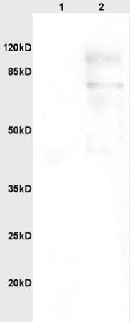 Western blot - Anti-PARP1 antibody (AB218132)