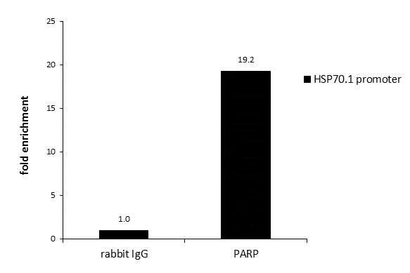 ChIP - Anti-PARP1 antibody (AB227244)