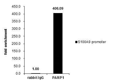 ChIP - Anti-PARP1 antibody (AB227244)