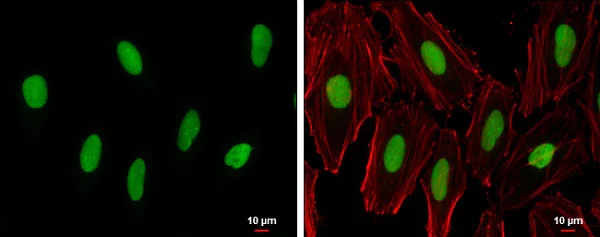 Immunocytochemistry/ Immunofluorescence - Anti-PARP1 antibody (AB227244)