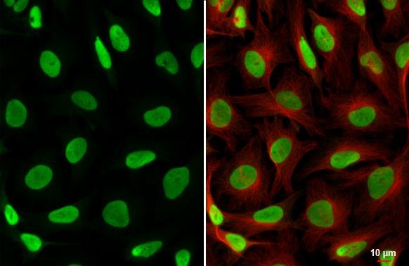 Immunocytochemistry/ Immunofluorescence - Anti-PARP1 antibody (AB227244)