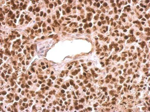 Immunohistochemistry (Formalin/PFA-fixed paraffin-embedded sections) - Anti-PARP1 antibody (AB227244)