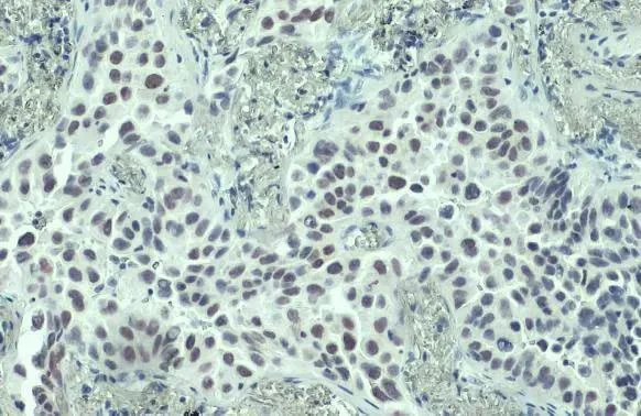 Immunohistochemistry (Formalin/PFA-fixed paraffin-embedded sections) - Anti-PARP1 antibody (AB227244)