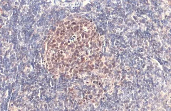 Immunohistochemistry (Formalin/PFA-fixed paraffin-embedded sections) - Anti-PARP1 antibody (AB227244)