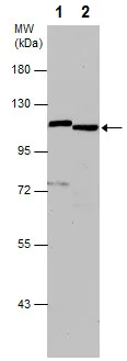 Western blot - Anti-PARP1 antibody (AB227244)