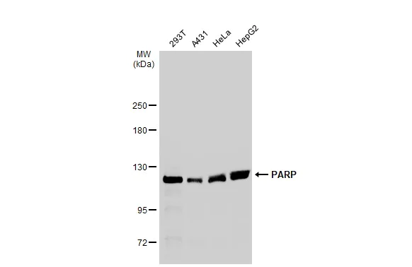 Western blot - Anti-PARP1 antibody (AB227244)