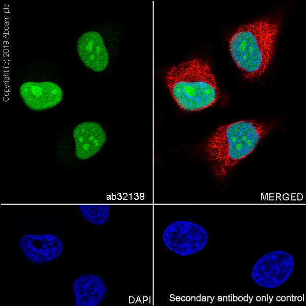 Immunocytochemistry/ Immunofluorescence - Anti-PARP1 antibody [E102] (AB32138)