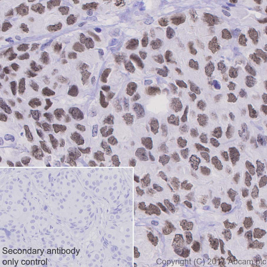 Immunohistochemistry (Formalin/PFA-fixed paraffin-embedded sections) - Anti-PARP1 antibody [E102] (AB32138), expandable thumbnail