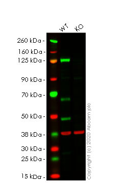 Western blot - Anti-PARP1 antibody [E102] (AB32138), expandable thumbnail
