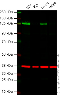 Western blot - Anti-PARP1 antibody [E102] (AB32138), expandable thumbnail