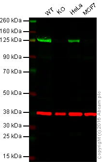 Western blot - Anti-PARP1 antibody [E102] (AB32138)