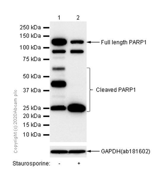 Western blot - Anti-PARP1 antibody [E102] (AB32138), expandable thumbnail