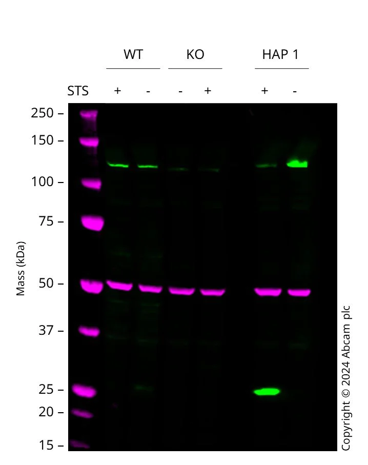 Western blot - Anti-PARP1 antibody [E102] (AB32138)