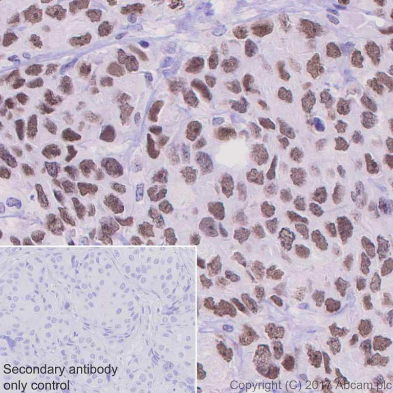 Immunohistochemistry (Formalin/PFA-fixed paraffin-embedded sections) - Anti-PARP1 antibody [E102] - BSA and Azide free (AB221923)