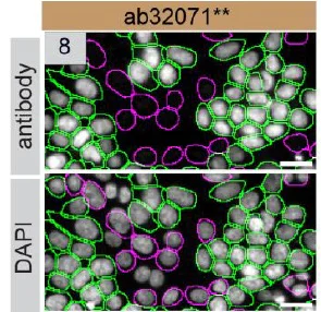 Immunocytochemistry/ Immunofluorescence - Anti-PARP1 antibody [E78] (AB32071)