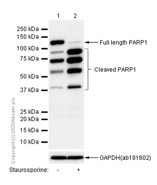 Western blot - Anti-PARP1 antibody [E78] (AB32071)
