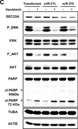 Western blot - Anti-PARP1 antibody [E78] (AB32071), expandable thumbnail
