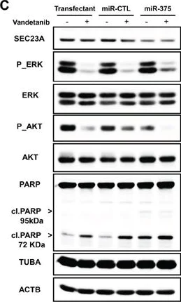 Western blot - Anti-PARP1 antibody [E78] (AB32071)