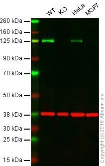 Western blot - Anti-PARP1 antibody [E78] (AB32071)