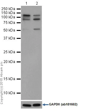 Western blot - Anti-PARP1 antibody [EPR18461] (AB191217)
