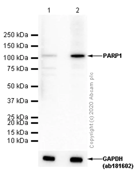 Western blot - Anti-PARP1 antibody [EPR18461] (AB191217)