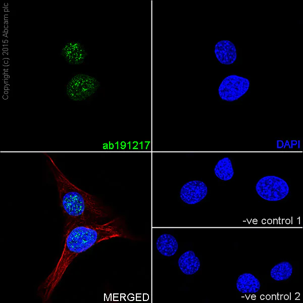 Immunocytochemistry/ Immunofluorescence - Anti-PARP1 antibody [EPR18461] - BSA and Azide free (AB222234)