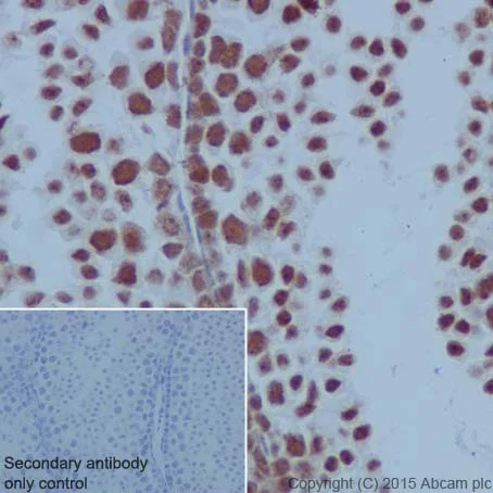 Immunohistochemistry (Formalin/PFA-fixed paraffin-embedded sections) - Anti-PARP1 antibody [EPR18461] - BSA and Azide free (AB222234)