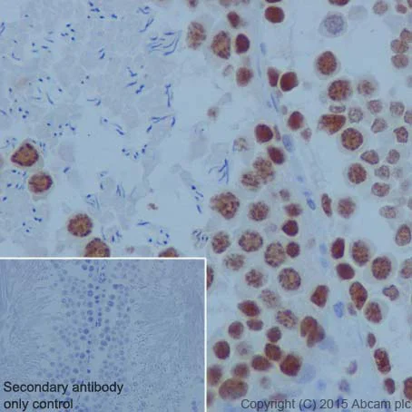 Immunohistochemistry (Formalin/PFA-fixed paraffin-embedded sections) - Anti-PARP1 antibody [EPR18461] - BSA and Azide free (AB222234)